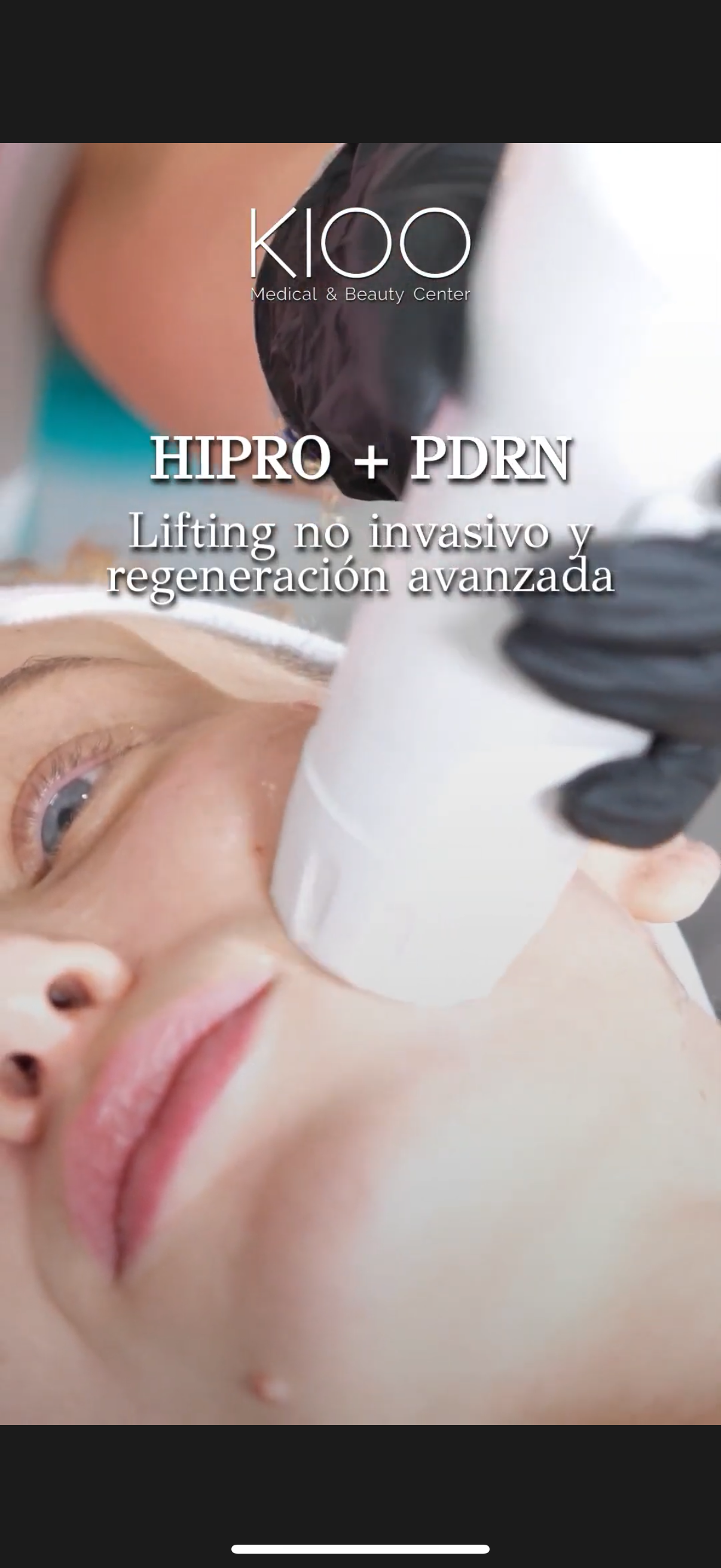 HIPRO 1 SESION + PDRN